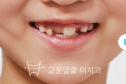치료후기 이미지